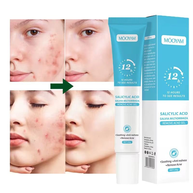 Crème de visage pour boutons