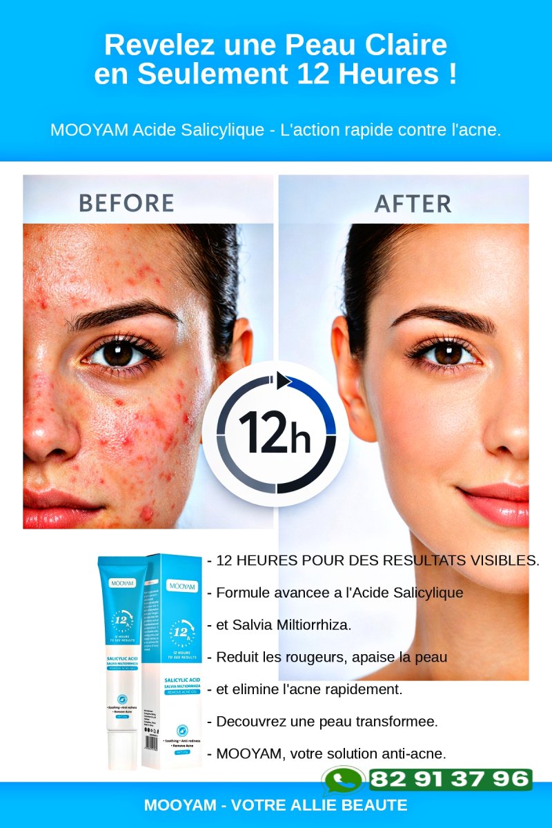 Le gel anti-acné Môoyam 🥰