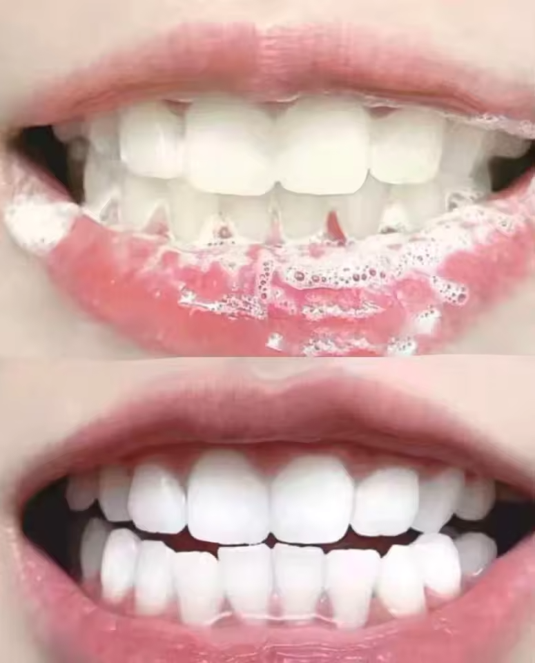 Dentifrice blanchissant