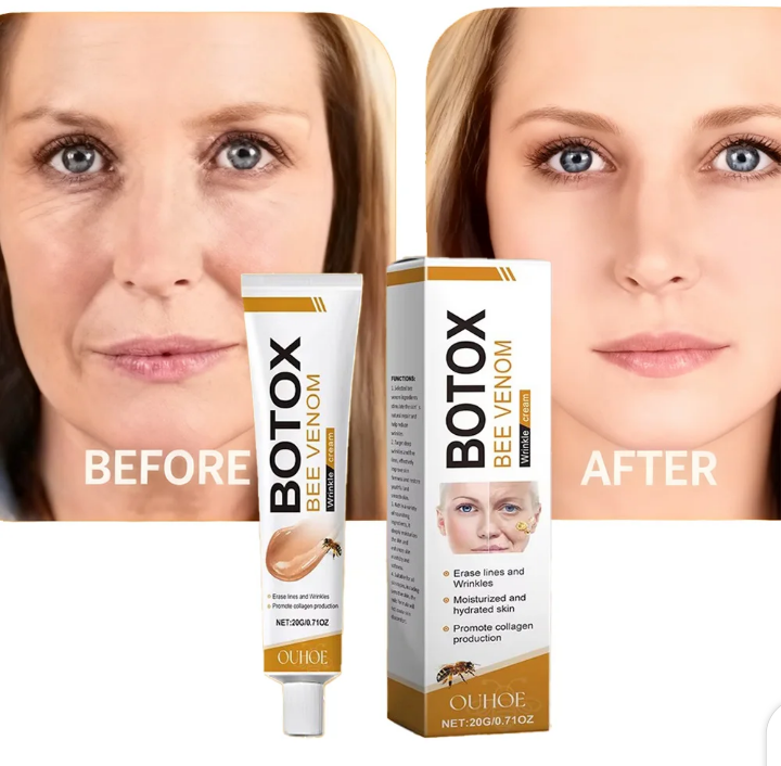 Botox