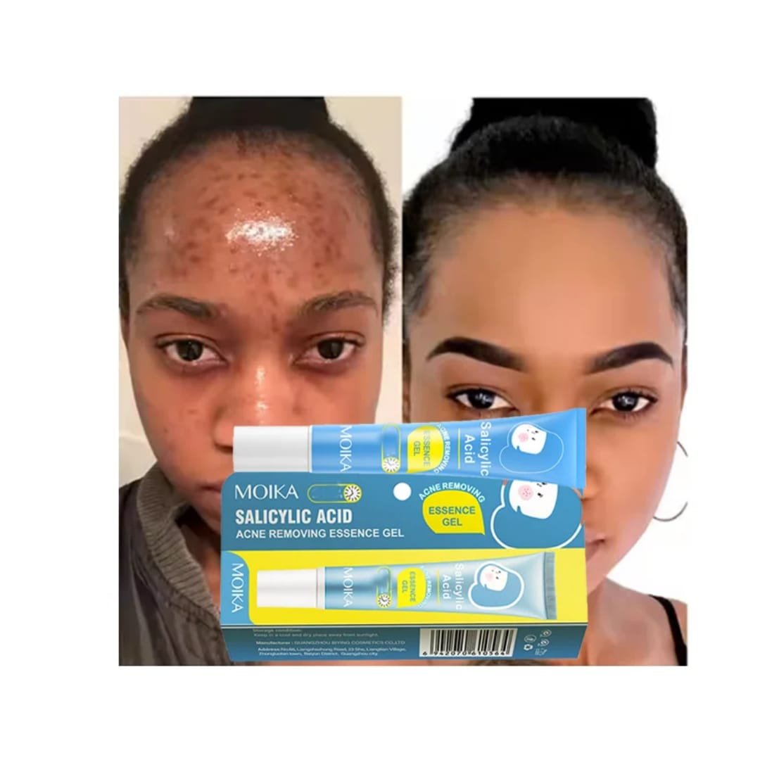 GEL ANTI - ACNÉ MOIKA À L'ACIDE SALICYLIQUE