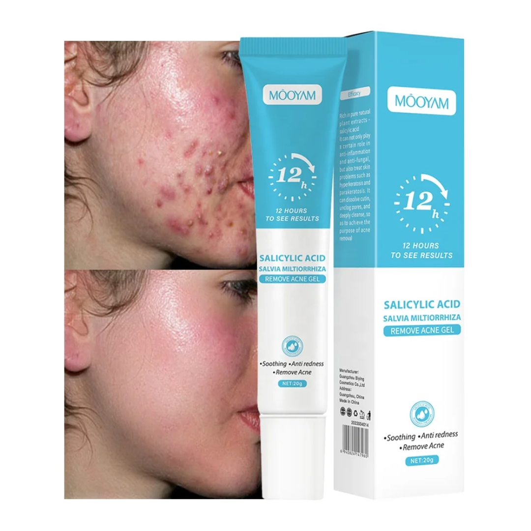 Le gel anti-acné Môoyam 🥰