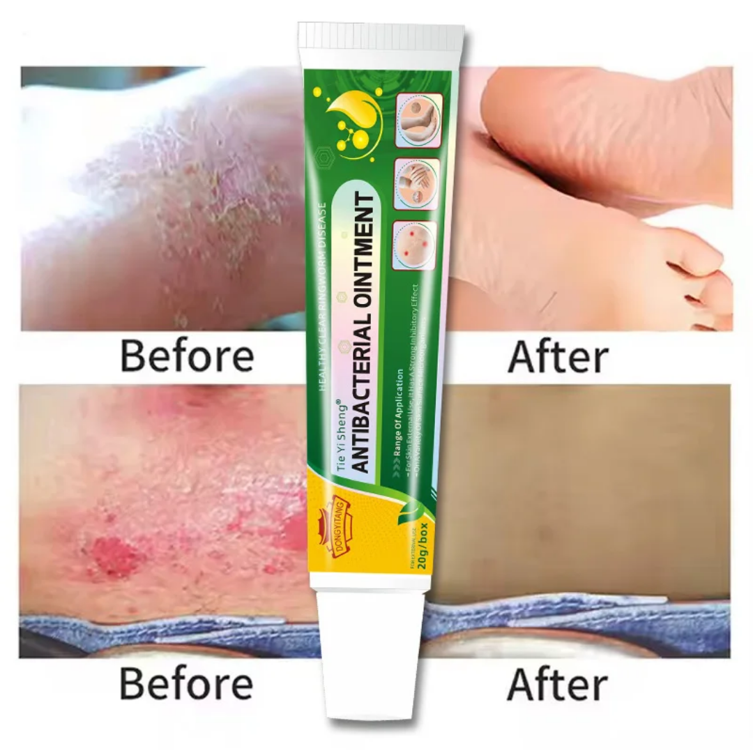 Pommade d'infection