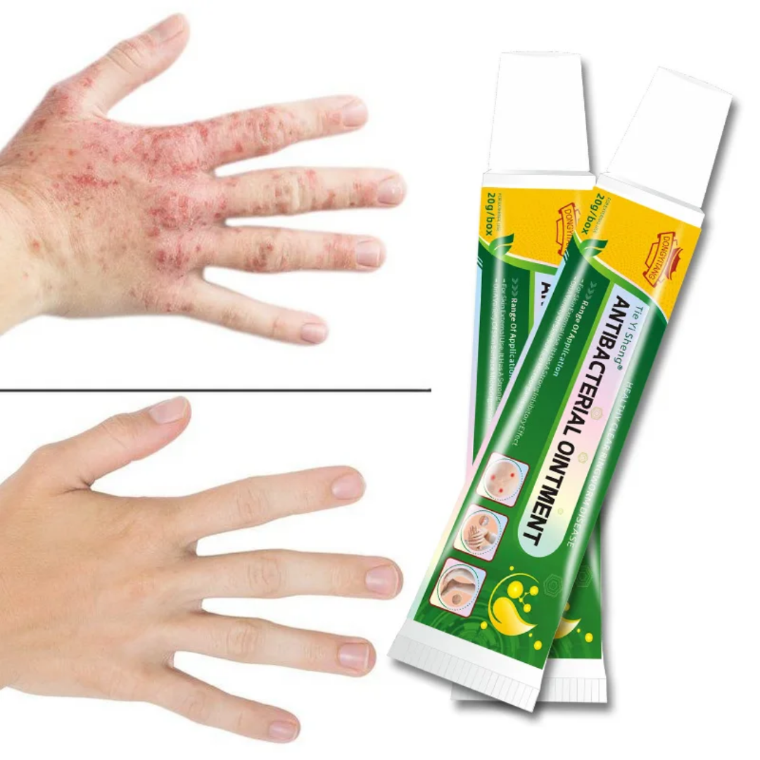 Pommade d'infection