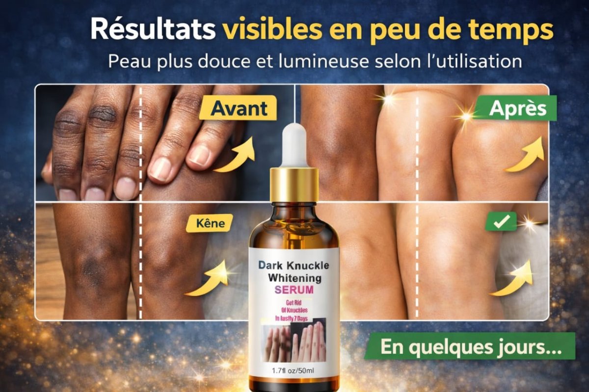 Sérum éclaircissant Anti Naches Noires ( Dark knuckle whitening Sérum )