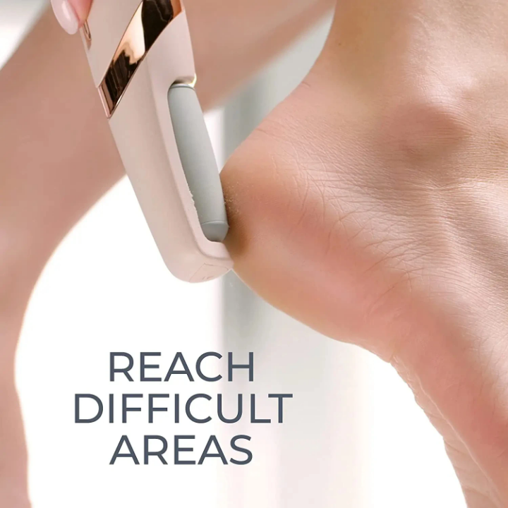 Ponceuse Électrique pour Pieds Rechargeable – Des Pieds Doux en Quelques Minutes ! ✨🦶