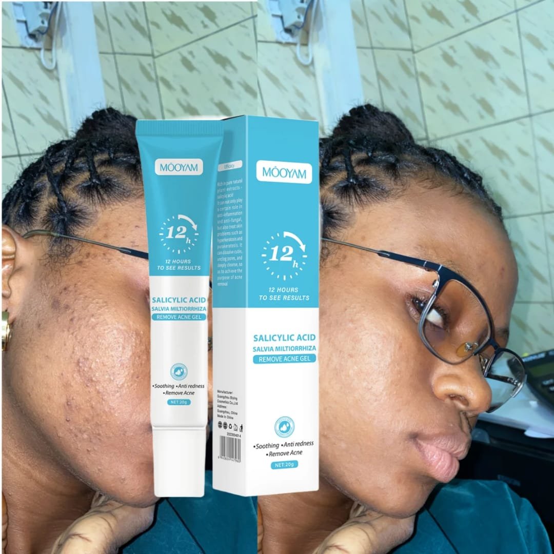 Crème de visage anti-acné