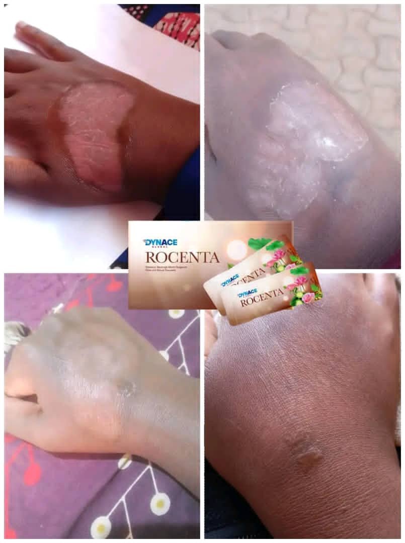 DYNACE ROCENTA