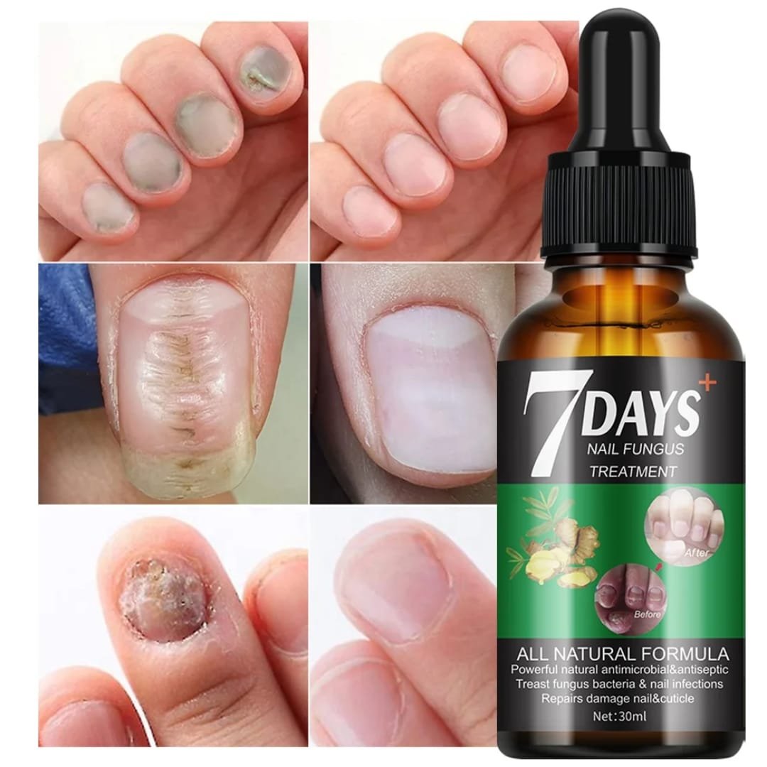 Sérum Anti-Mycoses Ongles
