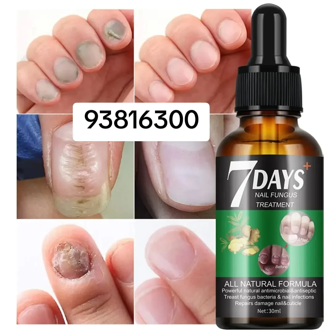 Sérum Anti-Mycoses Ongles(7jours)