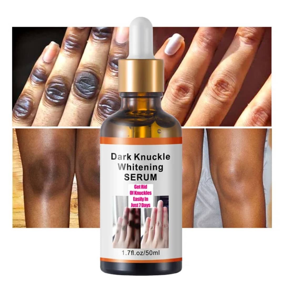Sérum éclaircissant Anti Naches Noires ( Dark knuckle whitening Sérum )