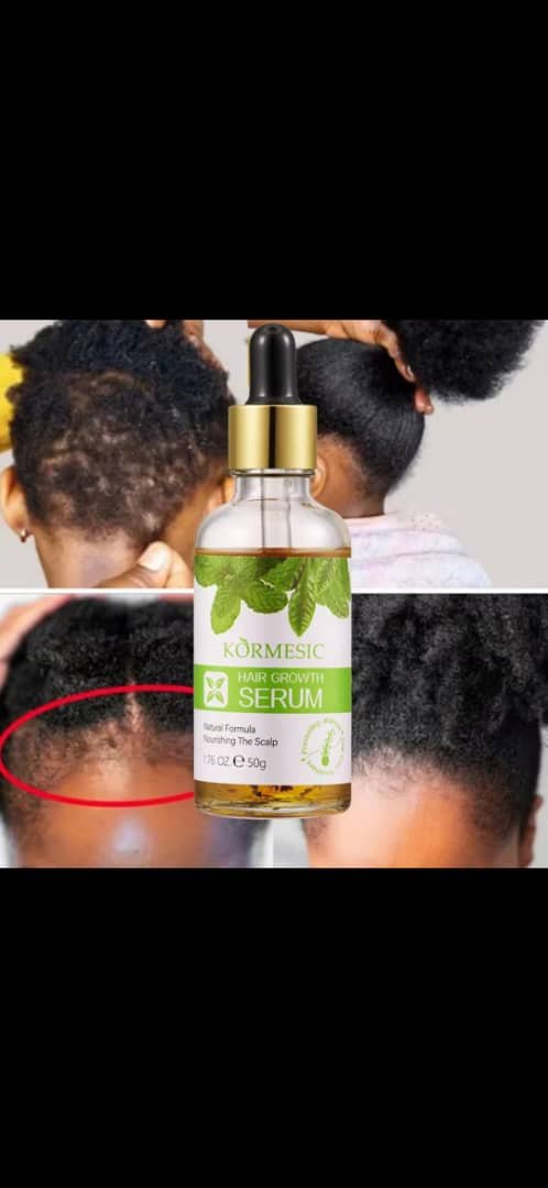 ✨ KORMESIC Hair Growth Serum ✨