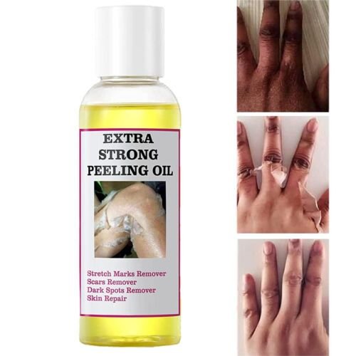 Huile peeling