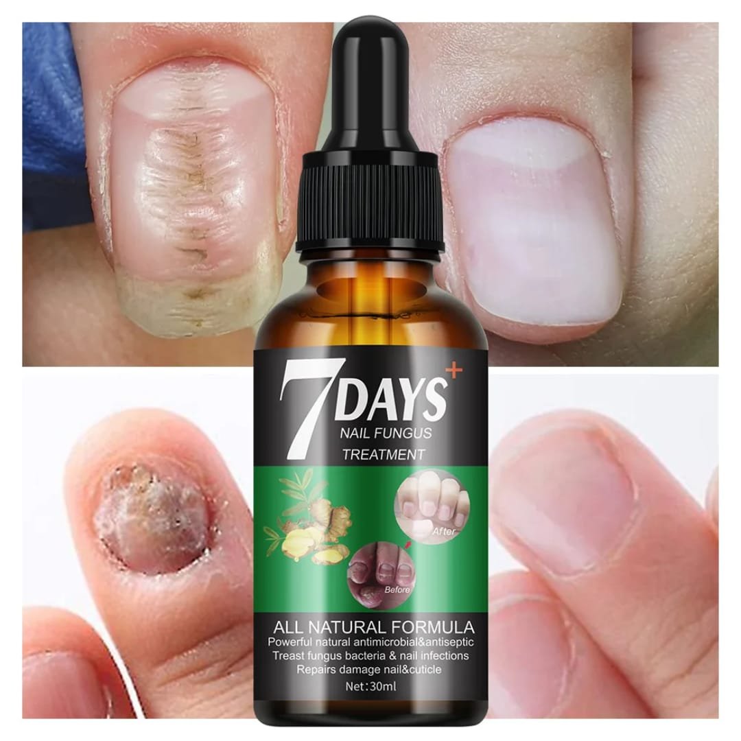 Sérum Anti-Mycoses Ongles