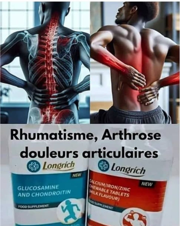 CALCIUM ET ARTHRO