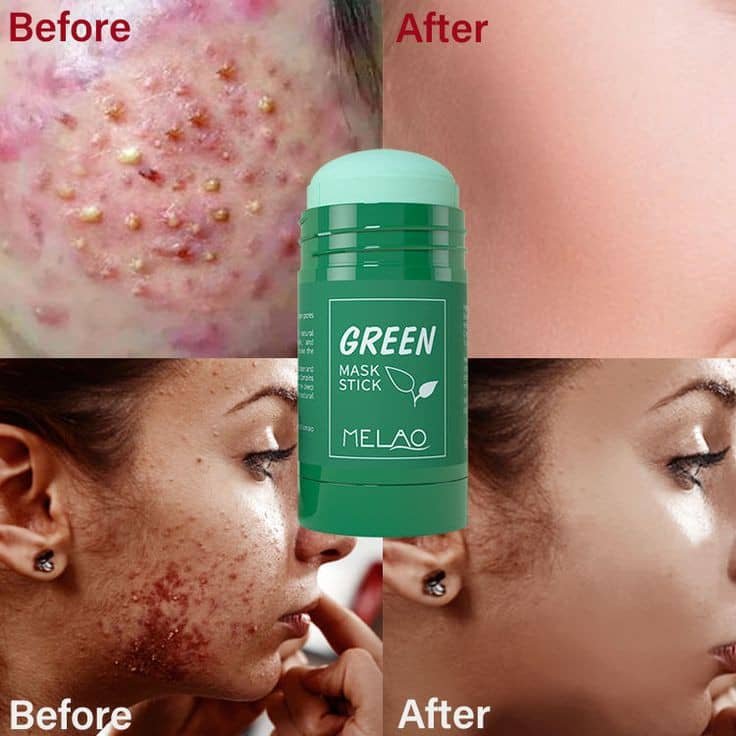 Masque visage GREEN MASK STICK Nettoyage profond
