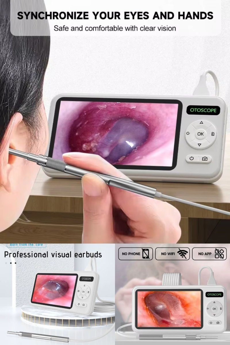 Otoscope électronique (nettoyeur d'oreille)