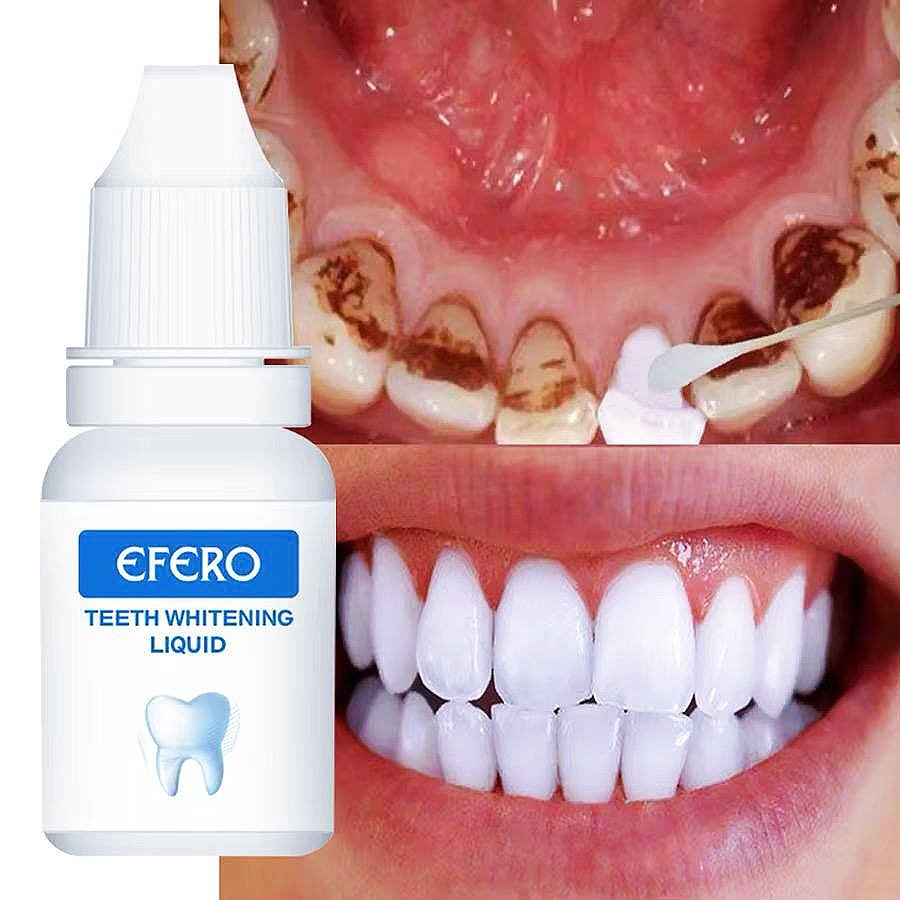 L'essence de blanchiment des dents EFERO