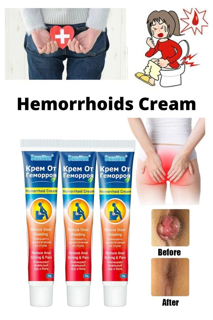 La crème anti-hémorroïde