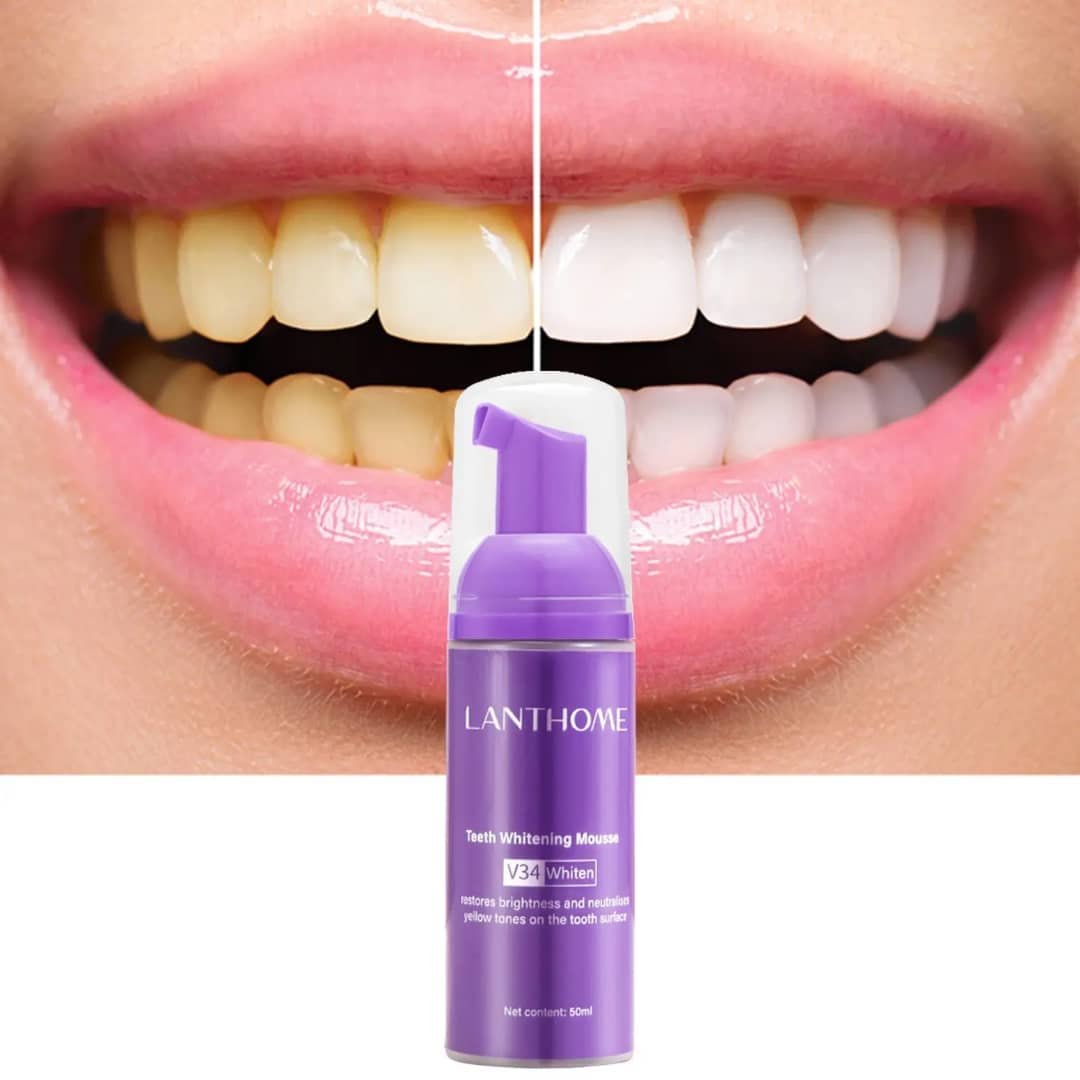 Mousse Blanchissante pour dents-sourire Éclatant
