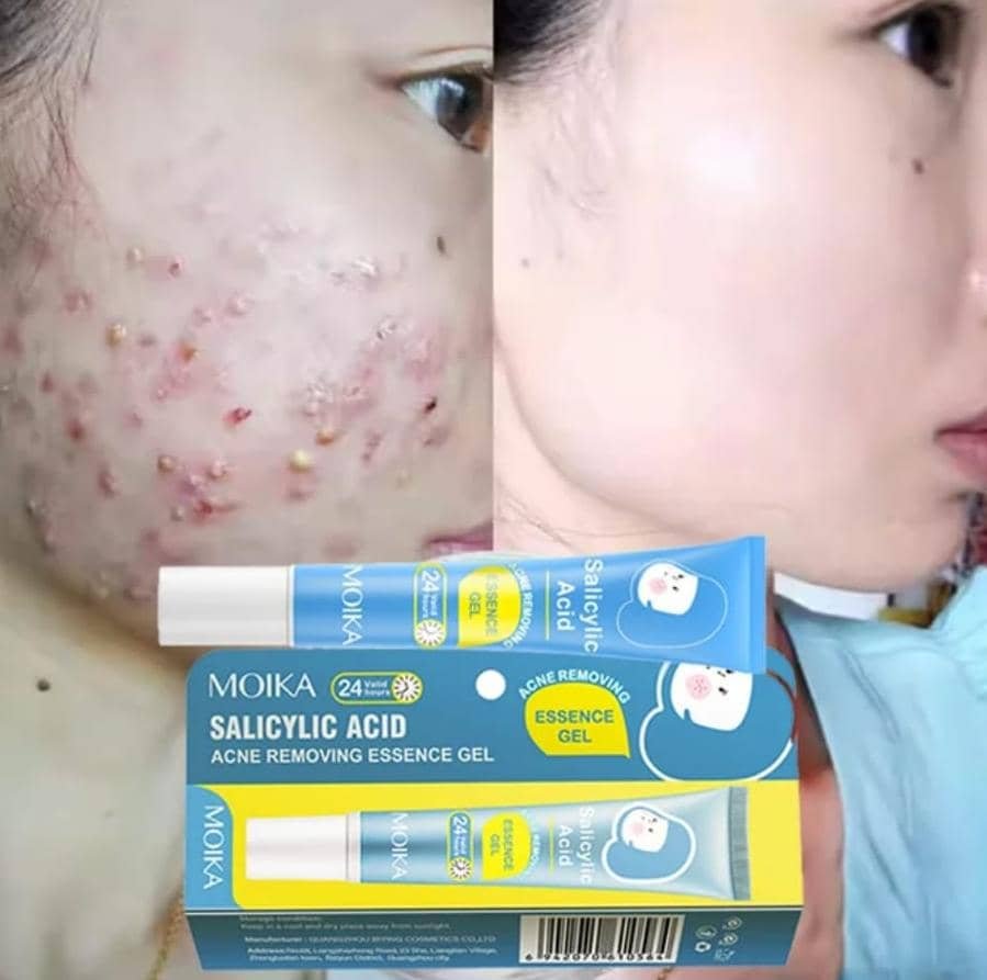 Gel anti acné MOICA à l'acide salicylique