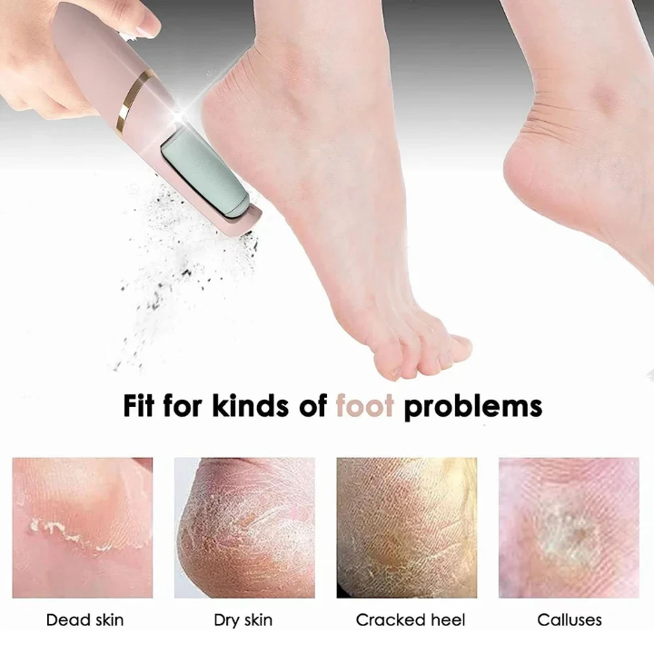 Ponceuse Électrique pour Pieds Rechargeable – Des Pieds Doux en Quelques Minutes ! ✨🦶
