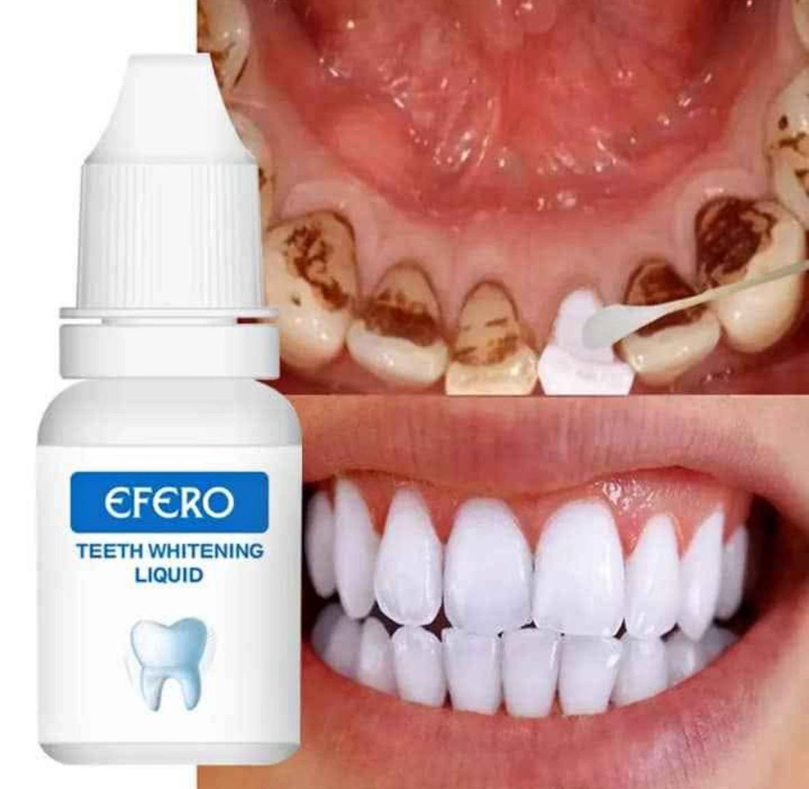 SÉRUM BLANCHISSANT EFERO – SOURIRE ÉCLATANT