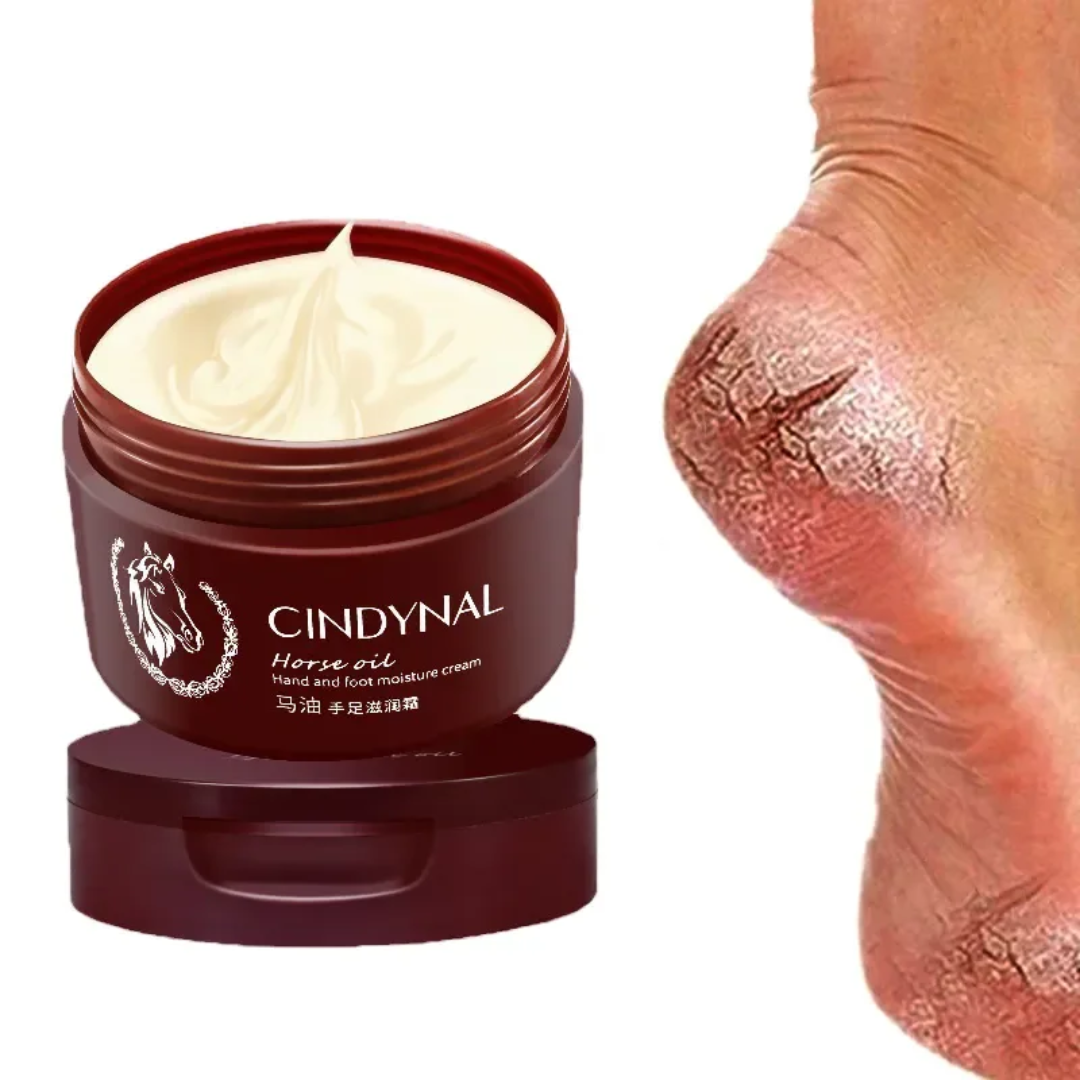 Crème hydratante pour les pieds fendillés et les mains