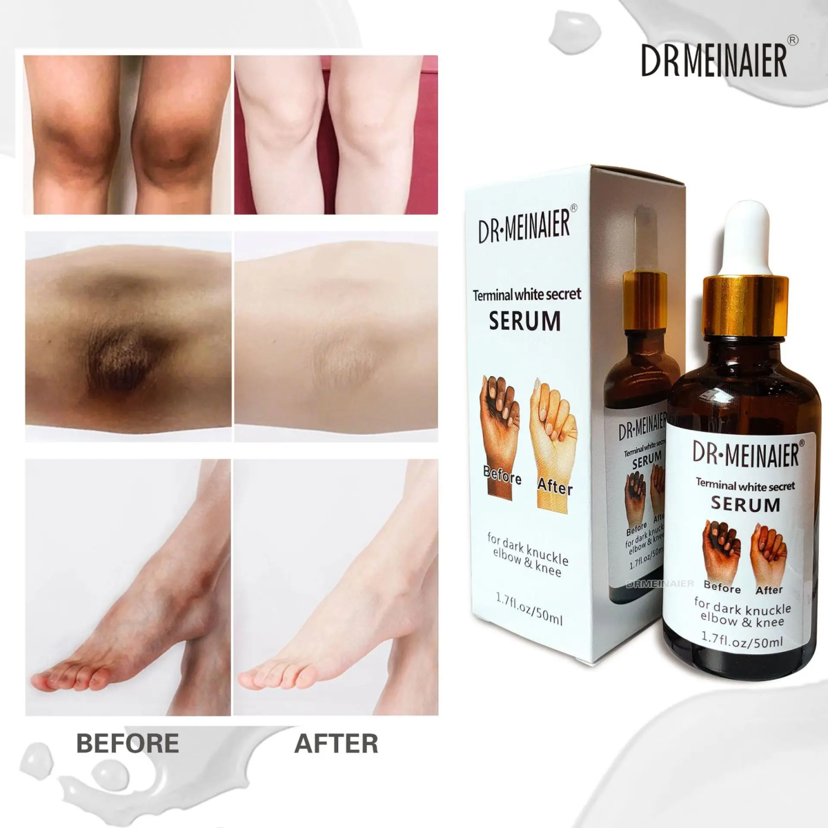Serum de kinto