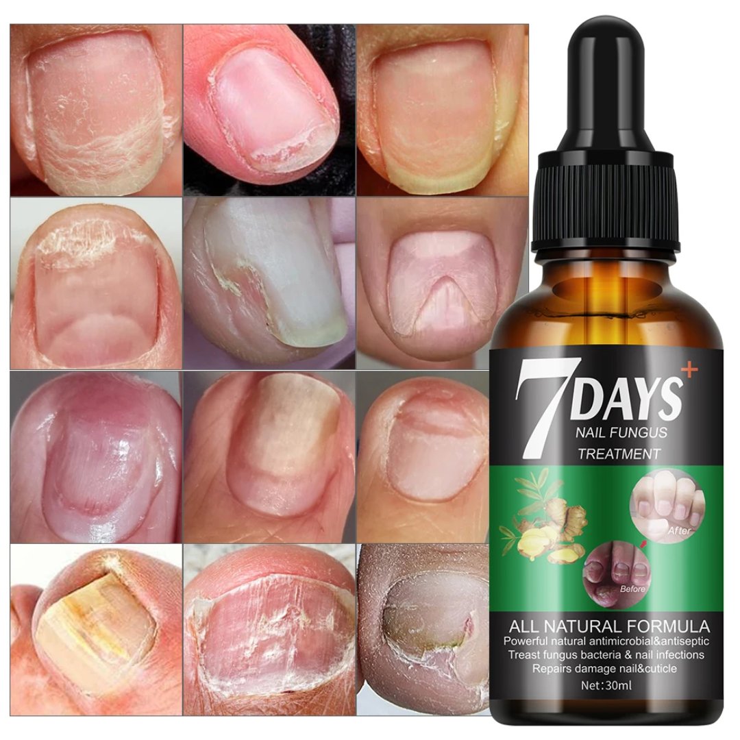 Huile d ongles